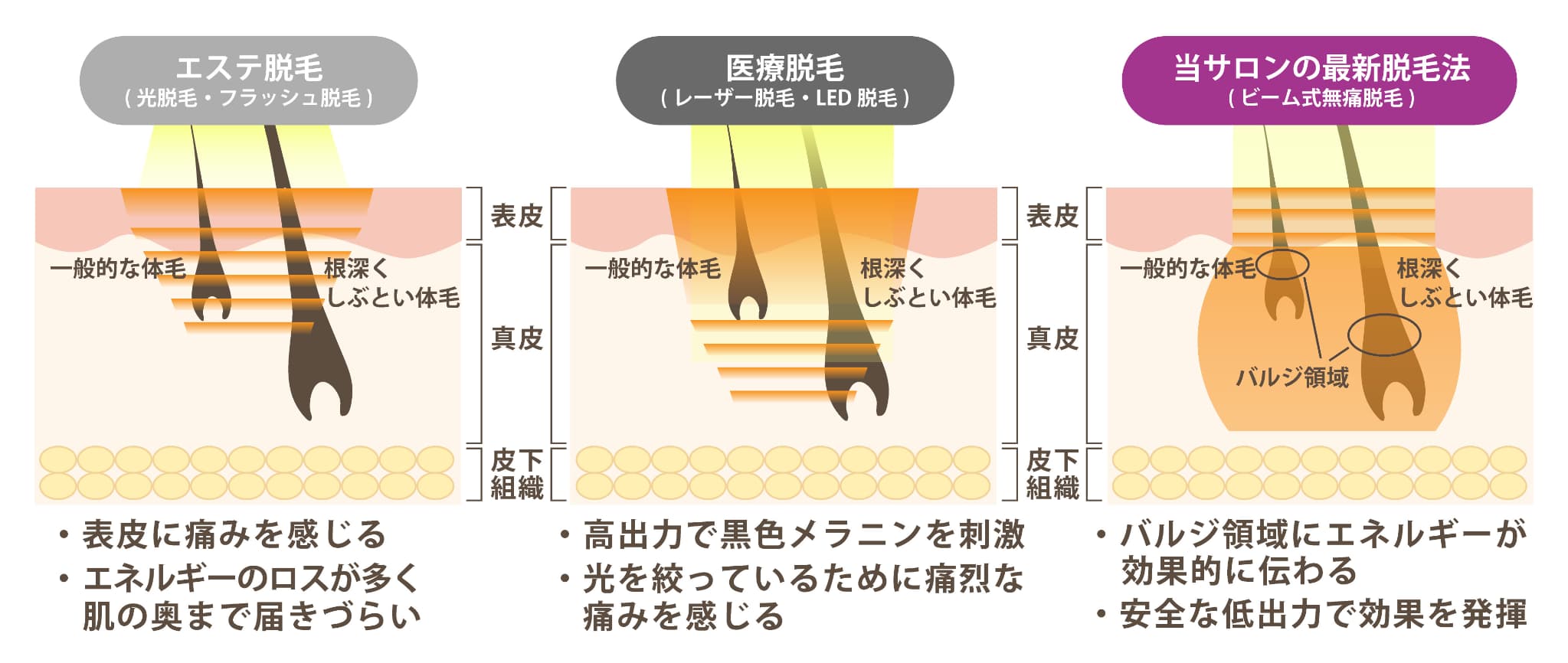 バルジ領域まで熱を届ける脱毛法の説明図